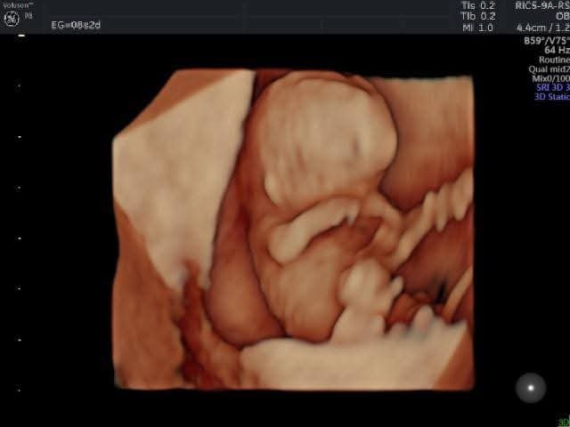 WhatsApp Image 2026-02-19 at 14.31.36 (4)