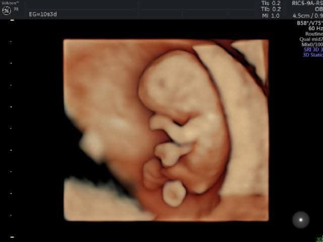 WhatsApp Image 2026-02-19 at 14.31.37